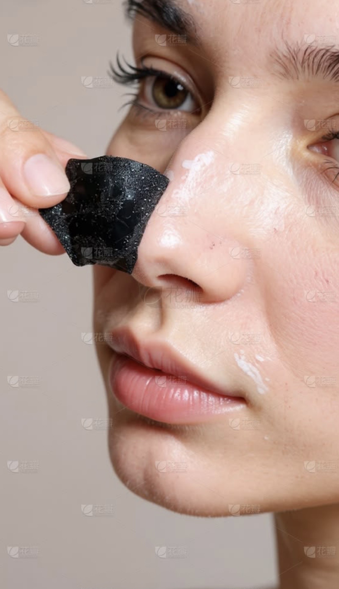 چسب سرسیاه بینی